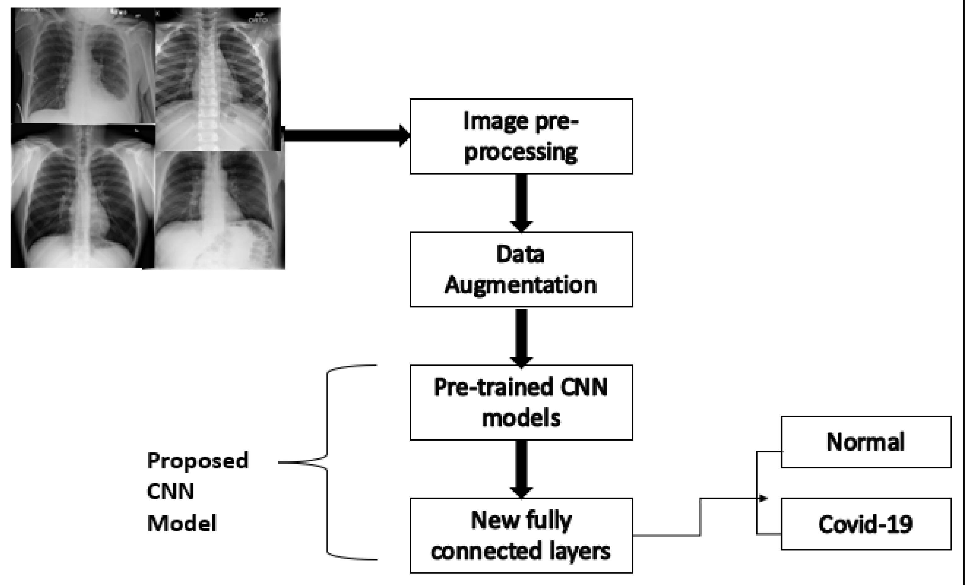 ResNet for X-ray Image Diagnosis